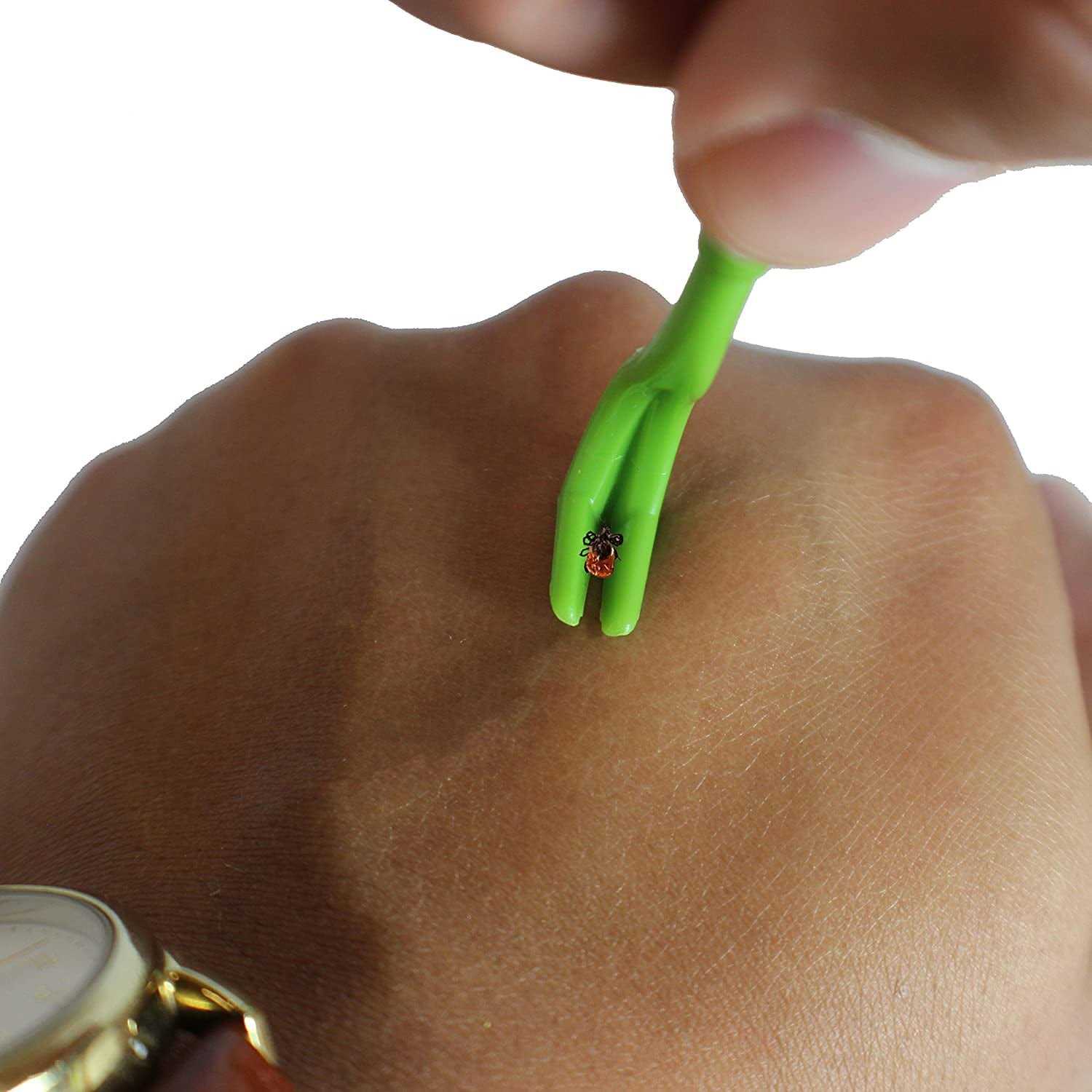 TickCheck Tick Remover Value 3 Pack Tick Remover Tools + Tick Identification Card