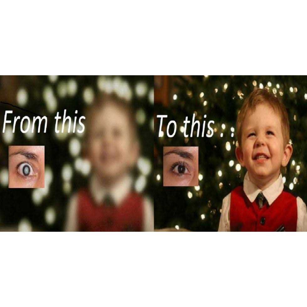 Cataract Eye Drops 4% NAC. Strongest anywhere.Proven on People & Pets. 2 x 10ml