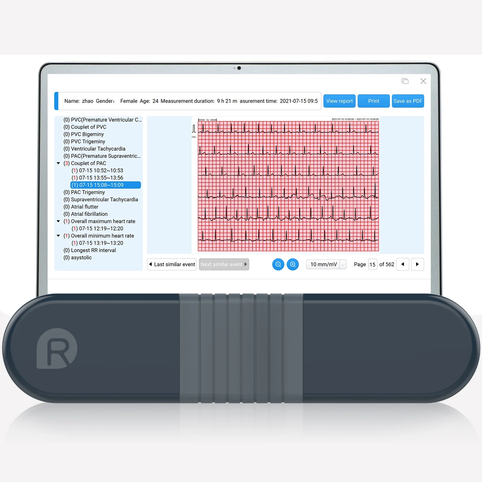 Wellue Personal EKG Monitor with AI Analysis,24 Hours ECG Heart Health Monitor for Sleep and Exercise,Home Heart Rate Recorder,Free PC Report
