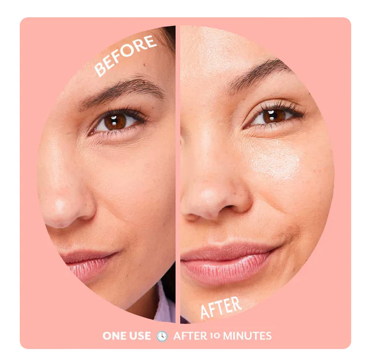 PATCHOLOGY-BUBBLY HYDROGEL MASK